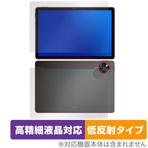 DOOGEE U11 \ w tB OverLay Plus Lite for hD[W[ ^ubg ׉tΉ A`OA ˖h~  wh~