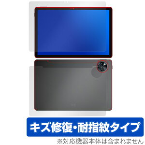 DOOGEE U11 \ w tB OverLay Magic for hD[W[ ^ubg C ώw wh~ R[eBO