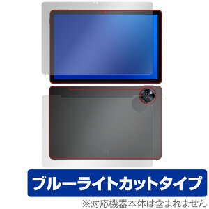 DOOGEE U11 \ w tB OverLay Eye Protector for hD[W[ ^ubg ڂɗD u[CgJbg