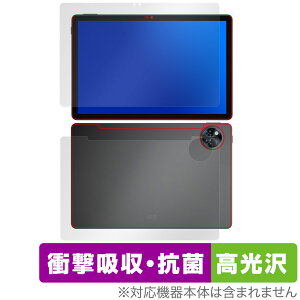 DOOGEE U11 \ w tB OverLay Absorber  for hD[W[ ^ubg Ռz R