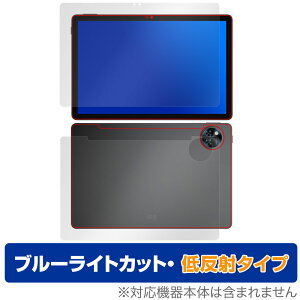 DOOGEE U11 \ w tB OverLay Eye Protector ᔽ for hD[W[ ^ubg u[CgJbg ˖h~