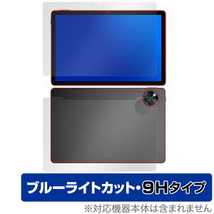 DOOGEE U11 \ w tB OverLay Eye Protector 9H for hD[W[ ^ubg 9H dx u[CgJbg