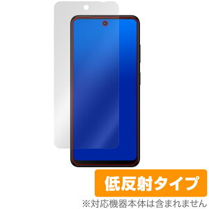 HMD Fusion �ی� �t�B���� OverLay Plus for �X�}�[�g�t�H�� �t���ی� �A���`�O���A ���˖h�~ ����� �w��h�~