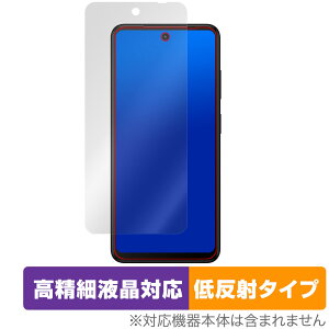 HMD Fusion �ی� �t�B���� OverLay Plus Lite for �X�}�[�g�t�H�� �t���ی� �����׉t���Ή� �A���`�O���A ���˖h�~ ����� �w��h�~