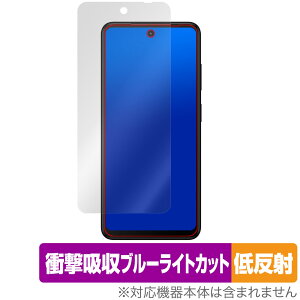 HMD Fusion �ی� �t�B���� OverLay Absorber �ᔽ�� for �X�}�[�g�t�H�� �Ռ��z�� ���˖h�~ �u���[���C�g�J�b�g �R��