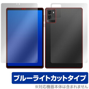 Lenovo Legion Tab (8.8hC3) \ w tB OverLay Eye Protector for m{ ^ubg MI Zbg u[CgJbg