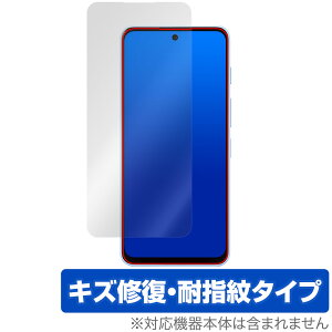 nubia S 5G A403ZT JȂ ی tB OverLay Magic for [bgeB[C[ krA C ώw wh~ R[eBO