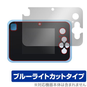 L~ƃAChvLA vbƂIvgCJ یtB OverLay Eye Protector for dqߋ u[CgJbg