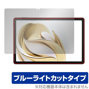 nubia Pad SE ی tB OverLay Eye Protector for krA pbh tی ڂɗD u[CgJbg