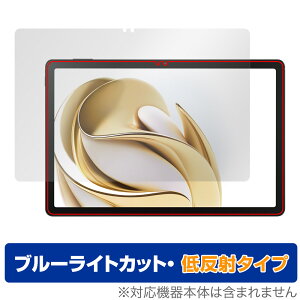 nubia Pad SE ی tB OverLay Eye Protector ᔽ for krA pbh tی u[CgJbg ˖h~