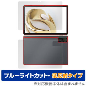 nubia Pad SE \ w tB OverLay Eye Protector ᔽ for krA pbh u[CgJbg ˖h~