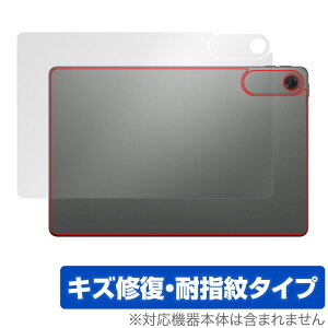 Lenovo Tab ZAEH0063JP w ی tB OverLay Magic for m{ ^ubg {̕یtB C wh~ R[eBO
