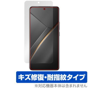 realme Neo7 �ی� �t�B���� OverLay Magic for ���A���~�[ �X�}�[�g�t�H�� �l�I �t���ی� ���C�� �ώw�� �w��h�~ �R�[�e�B���O