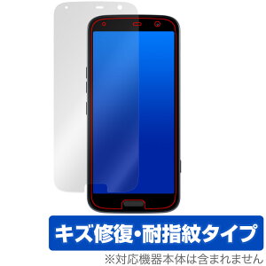 炭炭X}[gtH F-53E ی tB OverLay Magic for 炭炭z tی C ώw wh~ R[eBO