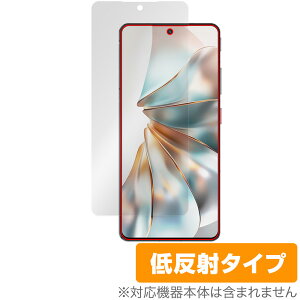 nubia Z60S Pro �ی� �t�B���� OverLay Plus for �k�r�A �X�}�[�g�t�H�� �[�b�g �t���ی� �A���`�O���A ���˖h�~ ����� �w��h�~