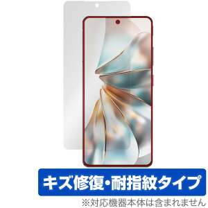 nubia Z60S Pro �ی� �t�B���� OverLay Magic for �k�r�A �X�}�[�g�t�H�� �[�b�g �t���ی� ���C�� �ώw�� �w��h�~ �R�[�e�B���O