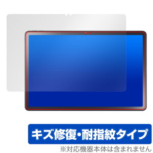 LAVIE Tab T11d �ی� �t�B���� OverLay Magic for NTT�h�R�� Android �^�u���b�g �t���ی� ���C�� �ώw�� �w��h�~ �R�[�e�B���O