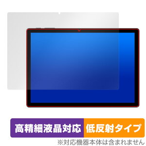 ALLDOCUBE iPlay 70S ی tB OverLay Plus Lite for I[hL[u ^ubg ׉tΉ A`OA ˖h~ wh~