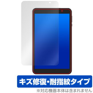 LUCA Tablet 8C` TE08D2M64-V1B یtB OverLay Magic for ACXI[} ^ubg C ώw wh~ R[eBO