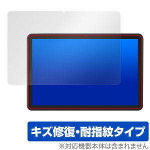 LUCA Tablet 10C` TE10D2M64-V1B یtB OverLay Magic for ACXI[} ^ubg C ώw wh~ R[eBO