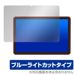 LUCA Tablet 10C` TE10D2M64-V1B یtB OverLay Eye Protector for ACXI[} ^ubg u[CgJbg