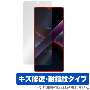 Xiaomi POCO X7 Pro ی tB OverLay Magic for VI~[ X}[gtH tی C ώw wh~ R[eBO