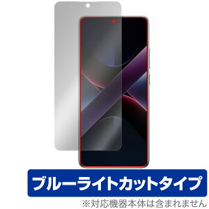 Xiaomi POCO X7 Pro ی tB OverLay Eye Protector for VI~[ X}[gtH tی ڂɗD u[CgJbg