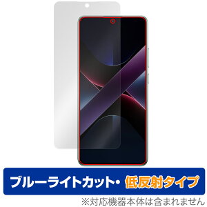 Xiaomi POCO X7 Pro ی tB OverLay Eye Protector ᔽ for VI~[ X}[gtH tی u[CgJbg ˖h~