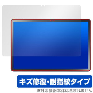 LAVIE Tab T11 T1165/KAS 25N tf یtB OverLay Magic for NEC ^ubg B C ώw wh~ R[eBO