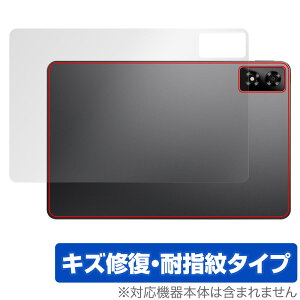 ALLDOCUBE iPlay 70 Pro w ی tB OverLay Magic for I[hL[u ^ubg ACvC C wh~ R[eBO