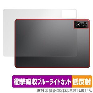 ALLDOCUBE iPlay 70 Pro w ی tB OverLay Absorber ᔽ for I[hL[u ^ubg ACvC Ռz R