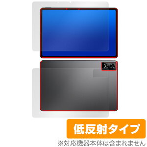 ALLDOCUBE iPlay 70 Pro \ w tB OverLay Plus for I[hL[u ACvC Zbg A`OA ˖h~ wh~