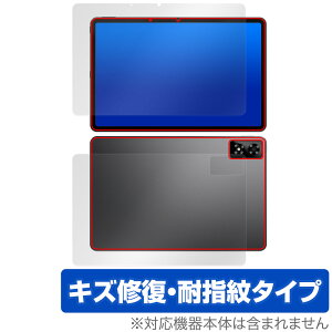 ALLDOCUBE iPlay 70 Pro \ w tB OverLay Magic for I[hL[u ACvC Zbg C ώw R[eBO