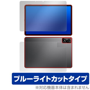 ALLDOCUBE iPlay 70 Pro \ w tB OverLay Eye Protector for I[hL[u ACvC ڂɗD u[CgJbg