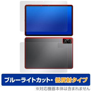 ALLDOCUBE iPlay 70 Pro \ w tB OverLay Eye Protector ᔽ for I[hL[u ACvC Zbg u[CgJbg