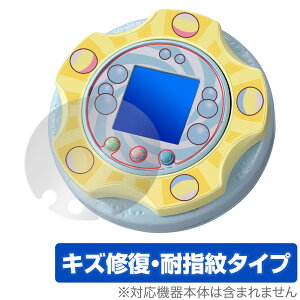 ݂R炵 ݂RK` ی tB OverLay Magic for  dqߋ tی C ώw wh~ R[eBO