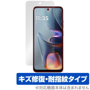 Motorola moto g05 ی tB OverLay Magic for g[ X}[gtH g C ώw wh~ R[eBO