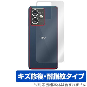 HMD Crest w ی tB OverLay Magic for X}[gtH {̕یtB C wh~ R[eBO