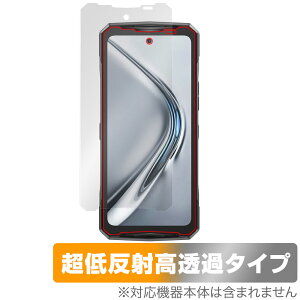 DOOGEE V40 Pro �ی� �t�B���� OverLay Plus Premium for �h�D�[�W�[ �X�}�[�g�t�H�� �t���ی� �A���`�O���A ���˖h�~ ������ �w��h�~