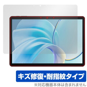 CHUWI Hi10 X1 ی tB OverLay Magic for c[EFC ^ubg tی C ώw wh~ R[eBO
