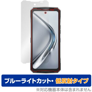 DOOGEE V40 ی tB OverLay Eye Protector ᔽ for hD[W[ X}[gtH tی u[CgJbg ˖h~