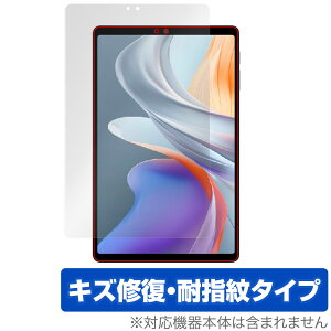 ALLDOCUBE iPlay 70 mini Ultra ی tB OverLay Magic for I[hL[u ^ubg C ώw wh~ R[eBO