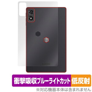ALLDOCUBE iPlay 70 mini Ultra w ی tB OverLay Absorber ᔽ for I[hL[u ^ubg Ռz ˖h~ R