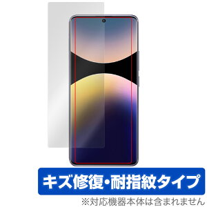 Xiaomi Redmi Note 14 Pro 5G یtB CJȂ OverLay Magic for h~ m[g 14 v C ώw wh~