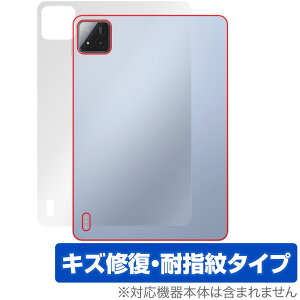 Xiaomi Pad 7 Pro Xiaomi Pad 7 11.2C` w یtB OverLay Magic for VI~[ ^ubg C wh~ R[eBO