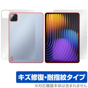 Xiaomi Pad 7 Pro Xiaomi Pad 7 11.2C` \ w tB OverLay Magic for VI~[ ^ubg C ώw wh~