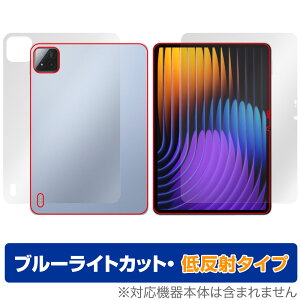 Xiaomi Pad 7 Pro Xiaomi Pad 7 11.2C` \ w tB OverLay Eye Protector ᔽ for VI~[ ^ubg ڂɗD