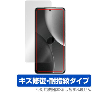 Xiaomi 15 Ultra �C���J�������Ȃ� �ی�t�B���� OverLay Magic for �V���I�~�[ �X�}�[�g�t�H�� ���C�� �ώw�� �w��h�~ �R�[�e�B���O