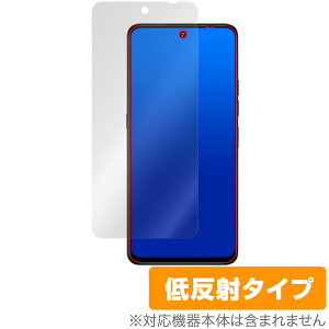 UMIDIGI Note 100 5G ی tB OverLay Plus for ~fBW X}[gtH tی A`OA ˖h~  wh~