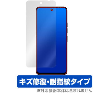UMIDIGI Note 100 5G ی tB OverLay Magic for ~fBW X}[gtH tی C ώw wh~ R[eBO